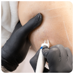 arañas_bonitamia_00 arañas_bonitamia_00